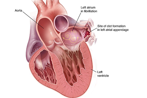 Watchman Heart Illo LAA 600x400v1