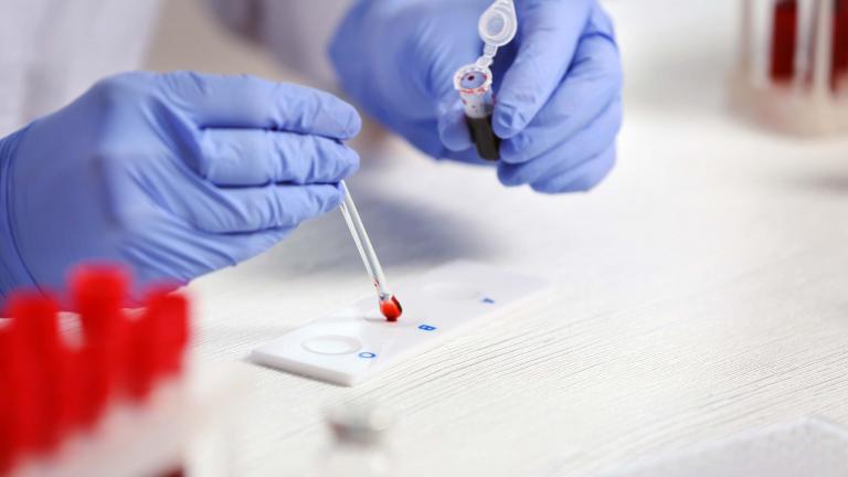 Scientist adding a blood samples to a test tray.