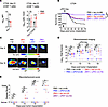 ZIKV and anti–PD-1 protect against glioma in mice.