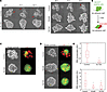 Mutant p53 promotes survival of detached fallopian tube nonciliated epithel