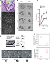 Mutant p53R175H (m-p53R175H) promotes survival of detached fallopian tube n