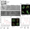 Integrin α5β1 supports mutant p53 (m-p53)–induced survival under detached c