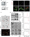 Mutant p53 (m-p53) promotes fibronectin secretion and mesenchymal transcrip