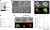 TWIST family BHLH transcription factor 1 (TWIST1) modulates phenotypes asso