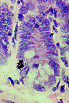 A small intestinal crypt (stained with hematoxylin and eosin) with autoradi