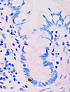 A human small intestinal crypt immunostained for telomerase. Labeling can b