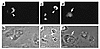 Inhibition of VacA-induced vacuolation in HeLa cells by transient transfect