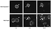 VacA internalization by HeLa cells is not affected by dominant-negative dyn