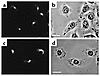 Intracellular localization of clathrin in VacA-treated and nontreated HeLa