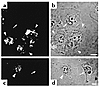 Inhibition of VacA-induced vacuolation in MKN28 human gastric mucosal cells