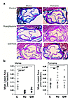 Atherosclerosis in LDLR–/– mice fed a high-fat, cholesterol-enriched Wester