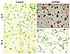 IL-4 blocks RANKL-mediated osteoclastogenesis by bone marrow macrophages. O