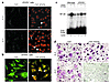 Exogenously added STAT6 blocks NF-κB activation and osteoclastogenesis. (a)