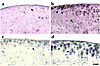 Photomicrographs of immunohistochemical analysis of knee joints from 5-mont