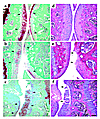 Photomicrographs of the articular cartilage of the tibia (right) and femur