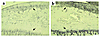 Photomicrographs to show localization of type X collagen in the tibia artic