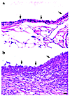 Photomicrographs to show synovial hyperplasia in 5-month-old mice removed f