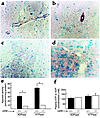 Expression of CD39 protein and apyrase activity. Immunostaining performed o