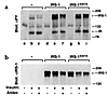 Ser307 in IRS-1 mediates the inhibitory effect of anisomycin on insulin-ind