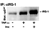 TNF-α and insulin act synergistically to promote phosphorylation of Ser307