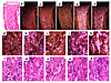 In situ hybridization analysis of trabecular bone. In situ hybridization wi