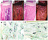 Osteoclast number and function. (a–d) In situ hybridization with the 35S-la