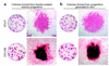 Colonies formed from freshly isolated bone marrow progenitors and from prog