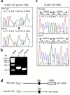 Identification of a 5′ splice junction mutation in JM2 IVS9 of XLAAD-100 in