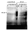 Activation of NF-κB in murine CIA. Mice were immunized with type II collage