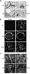 The β3 integrin cytoplasmic domain is essential for osteoclast spreading an