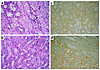 Renal histopathology (representative picture of at least three experiments)