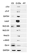 Expression of specific markers in the contracting EBs. Negative images of e