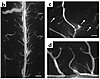 Spinal window preparation for direct intravital microscopic assessment of w