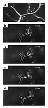 T lymphoblast/endothelium interaction within spinal white matter postcapill