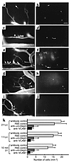 Involvement of α4-integrin and VCAM-1 in permanent T lymphoblast adherence