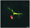 Localization of T lymphoblasts within the spinal cord parenchyma in control