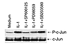 Effect of MAP kinase inhibitors on phospho-c-Jun (P-c-Jun) levels. Cultured