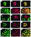 Localization of NHERF1, NHERF2, PC, and ezrin in the normal rat kidney. Str