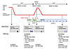 Study schema.