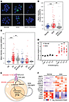 TGF-β pathway activation through TGF-βR1 suppresses hematopoiesis in SDS BM