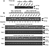 Detection of CpG island methylation in the p15 gene by PCR analysis. To dis