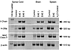 CNS expression of Ii and H-2M is upregulated during EAE. C57BL/6 mice were