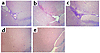 Histological evidence of EAE in wild-type, Ii p31, and Ii p41, but not Ii-