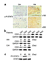 CIS3 and STAT3 activation in synovial tissue from patients with RA and OA.