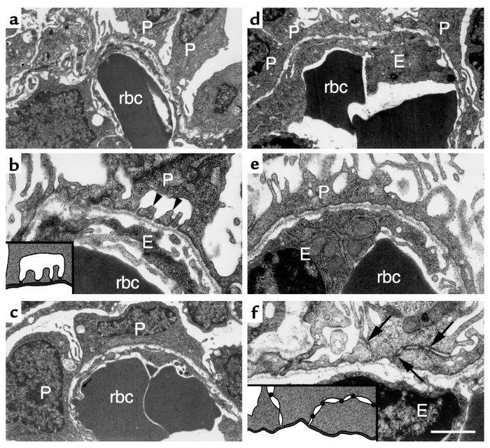 Ultrastructural analysis of podocytes from control and Lmx1b–/– newborn ...