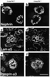 Immunohistochemical analysis of podocyte gene expression in Lmx1b+/+ and Lm