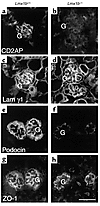 Immunohistochemical analysis of podocyte gene expression in Lmx1b+/+ and Lm