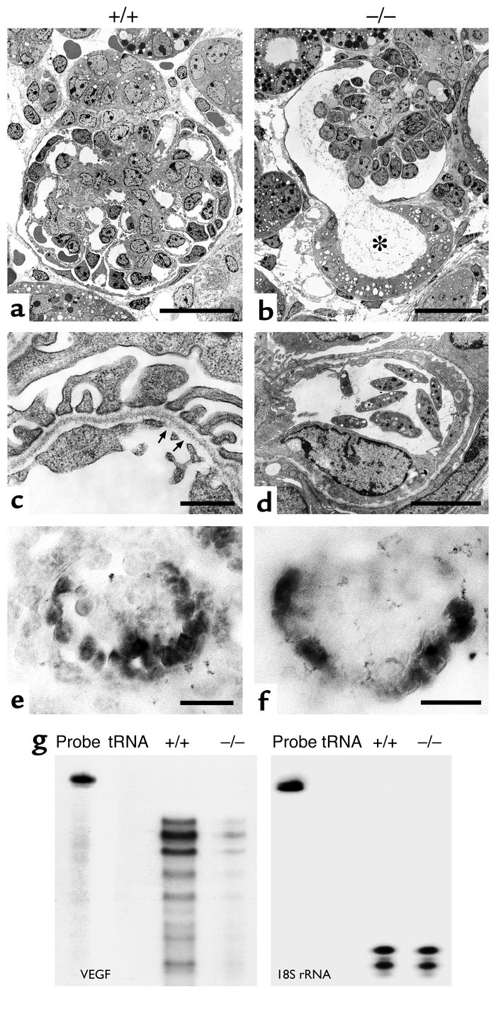 Development of the glomerular capillaries in Lmx1b–/– mice. A comparison...