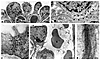 Podocyte differentiation in Lmx1b–/– mice. Podocytes in newborn homozygous