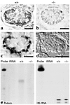 Expression of podocin in newborn Lmx1b–/– mice. Podocin protein (a) and mRN